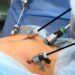 Laparoscopic Surgery Islamabad