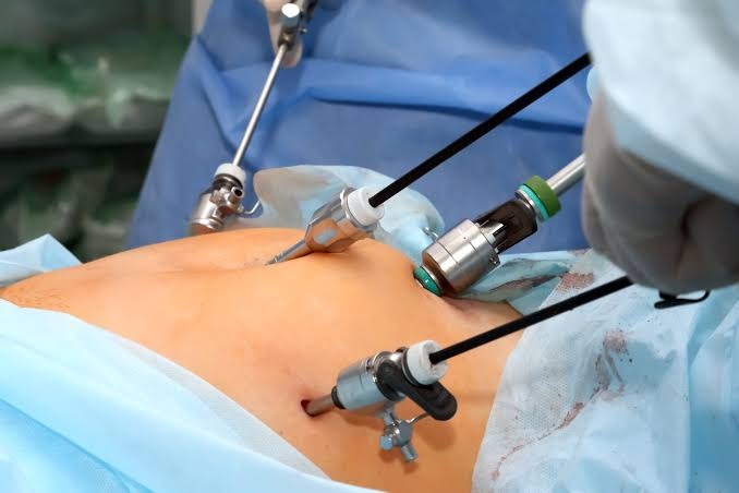Laparoscopic Surgery Islamabad