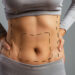 Best Tummy Tuck in Riyadh for a Flatter and More Defined Abdomen